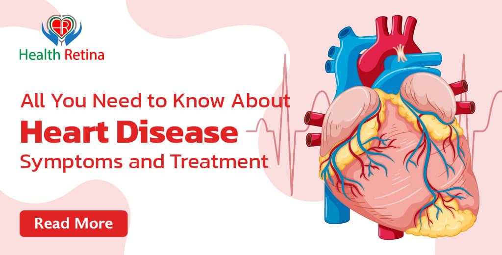 Heart Disease Symptoms and Treatment | Know About It
