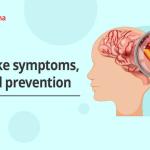 Brain stroke symptoms, causes and prevention