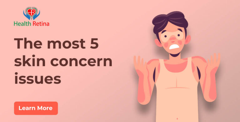 The most 5 skin concern issues