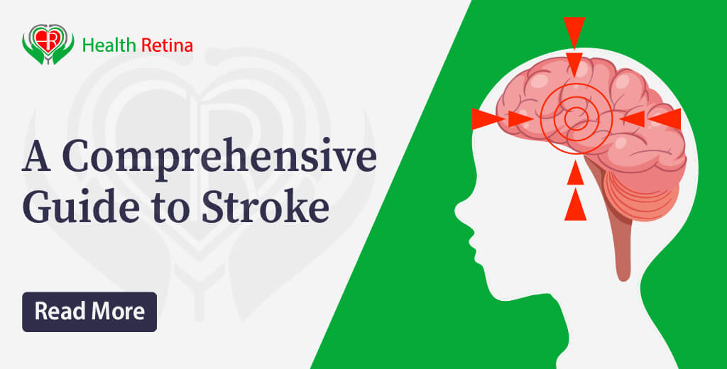 stroke-a-comprehensive-guide-to-stroke-health-retina