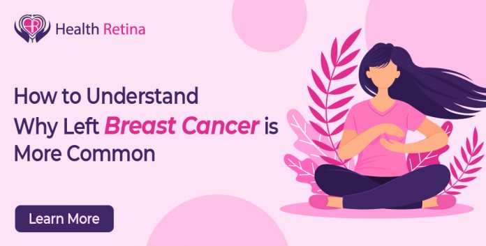 why is left breast cancer more common