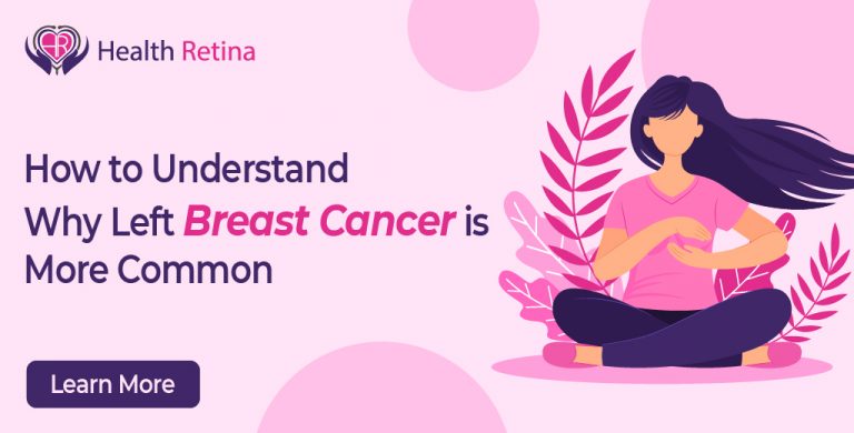 How to Understand Why Left Breast Cancer is More Common