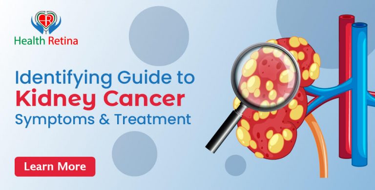 A Identifying guide to  Kidney Cancer symptoms & treatment