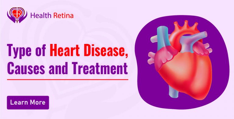 Type of Heart Disease, Causes and Treatment